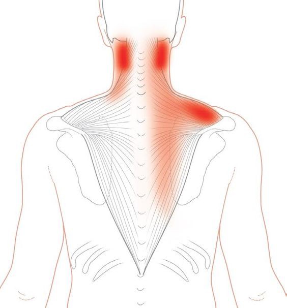 Trapezius